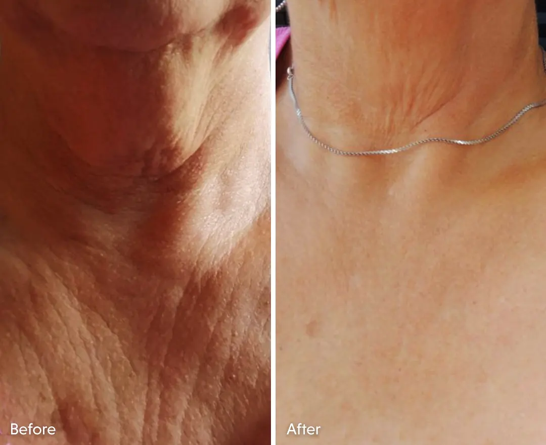 Testimonio Crema Reafirmante para el Contorno Corporal